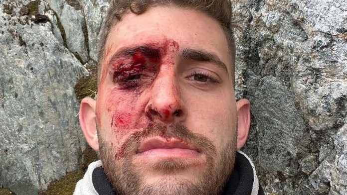 Pri Eitanovi Shakedovi (23) stáli počas výstupu na ľadovec všetci svätí.