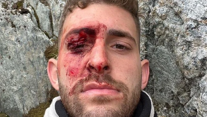 Pri Eitanovi Shakedovi (23) stáli počas výstupu na ľadovec všetci svätí.