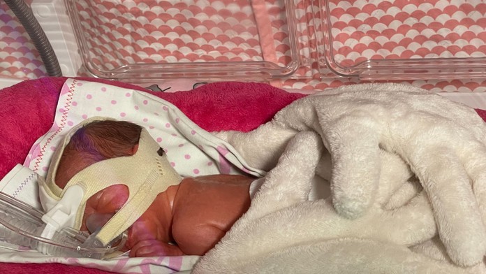 Trojnásobná radosť v Martine. Ukrajinka v nemocnici porodila trojičky