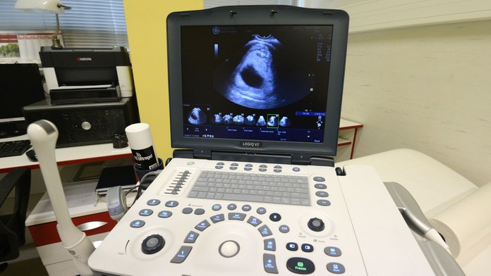 Tehotenstvo (ilustračná snímka)