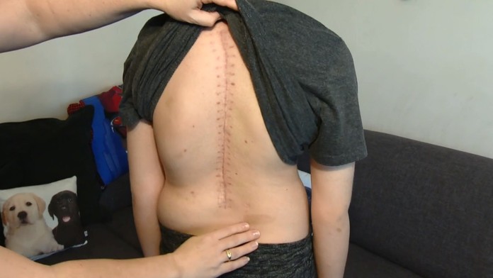 Chlapec chce podstúpiť náročnú operáciu.