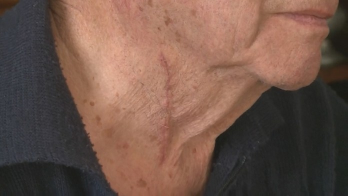 Rana po operácii krku