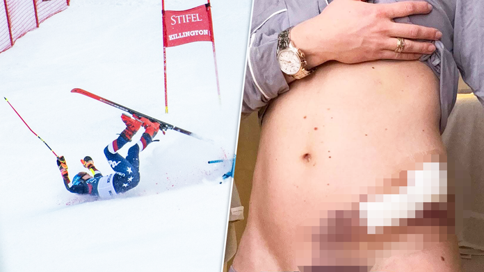 Mikaela Shiffrinová prehovorila o najťažšom období kariéry: V jednom momente som dostala skutočný strach