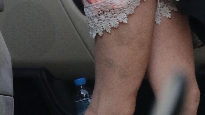 Búrlivá minulosť sa podpísala na jej výzore. 