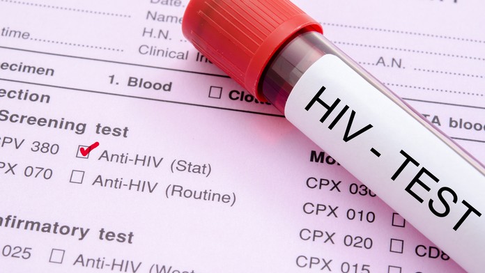 Vírus HIV- ilustračná snímka.