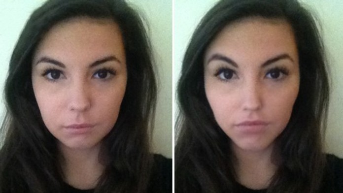 Mobilná aplikácia vám ukáže, akoby ste vyzerali pred a po zákroku. 