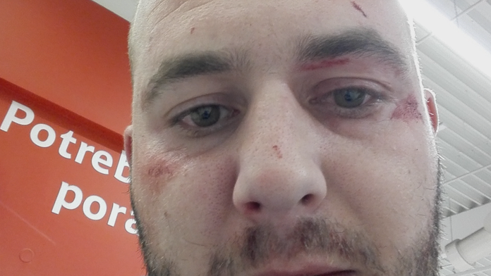 Mladého muža zbili pred obchodným domom pre nedorozumenie