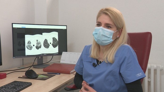 Manchester united a Manchester city