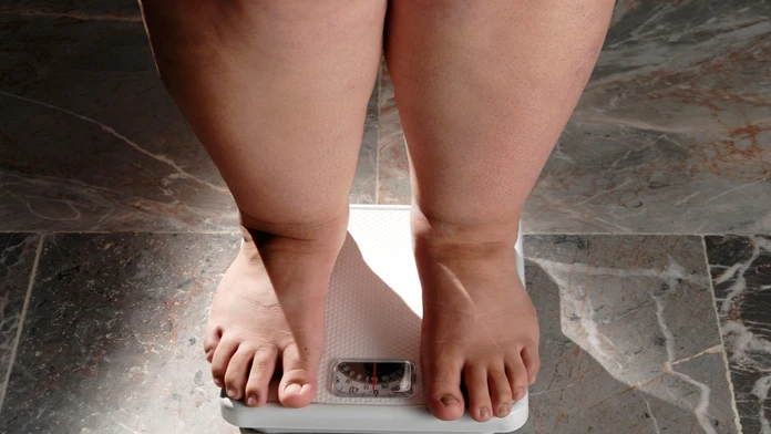 Zistenie, z ktorého budú mnohí prekvapení. Vedci našli hlavného vinníka obezity