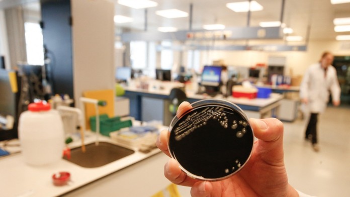 Baktérie Legionella pneumophila 