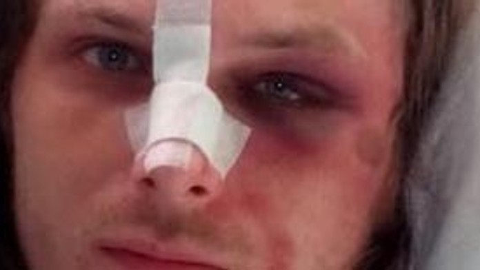 Muž skončil v nemocnici