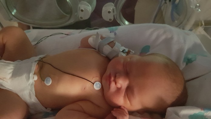 Izabelke pri páde praskla lebka.