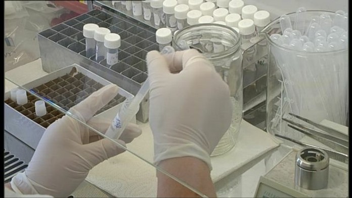 reflex, epidemia osypky