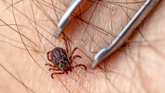 Čo robiť, ak neodstránite celého kliešťa? Tu sú rady, ako správne postupovať