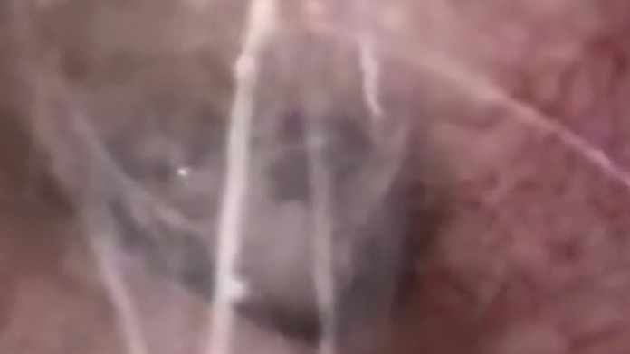 Mužovi sa do ucha nasťahoval pavúk.