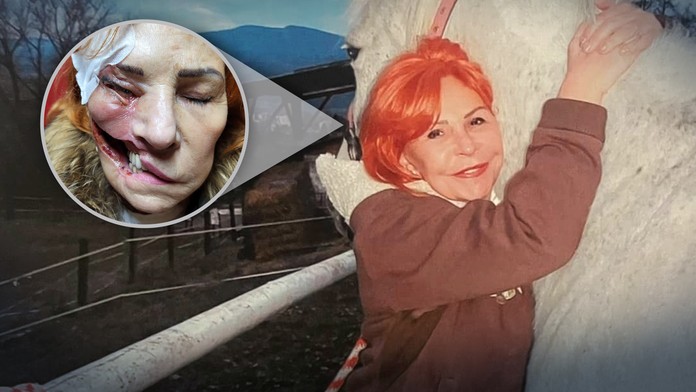 Parazit požiera Oľge tkanivo.