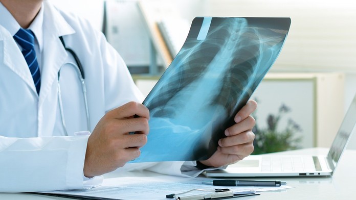 Vedci odhalili novú príčinu vzniku rakoviny pľúc (ilustračná snímka)