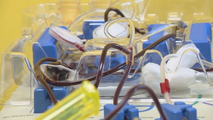 Samotný odber krvných doštičiek trvá hodinu a vie zachrániť niekoľko životov.