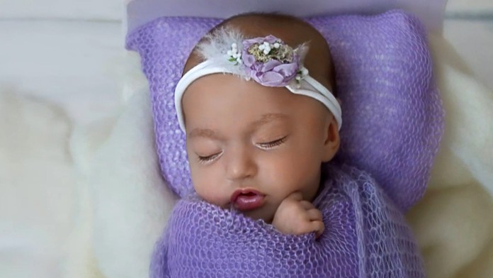 Malá Mia oslávi rok, ale je na úrovni mesačného bábätka. Rehabilitácia stojí veľa peňazí