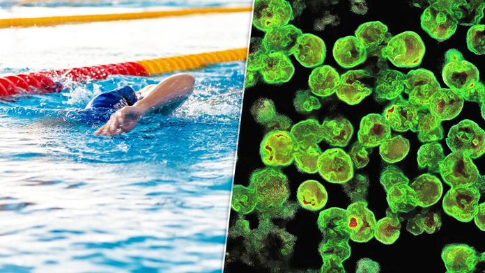 Nákaza slzovičkou zhubnou