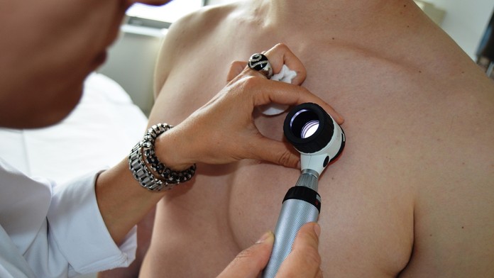 vysetrenie dermatoskopom 2.JPG