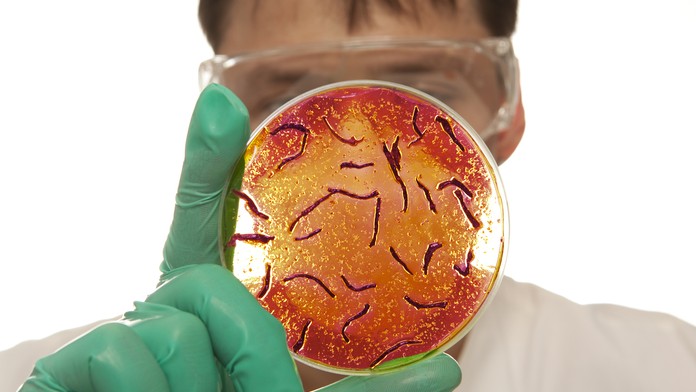 Cholera- ilustračná snímka.