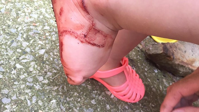 Pozor na to, aké topánky kupujete deťom.