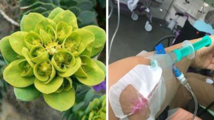 Žena sa poranila v záhrade, skončila v nemocnici.