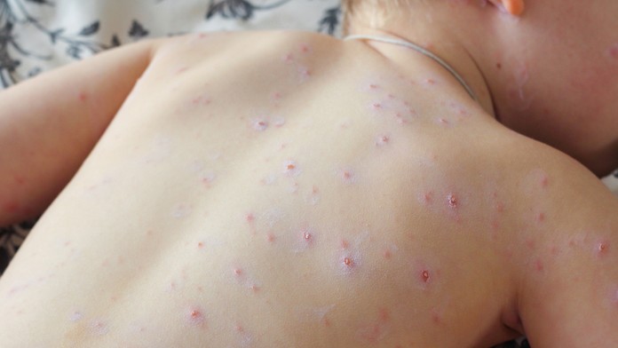 Ilustračná snímka.