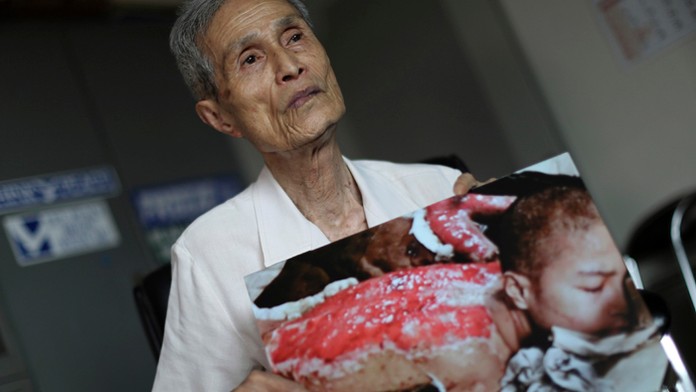 Sumiteru Taniguči drží fotografiu z roku 1945 po útoku na Nagasaki.