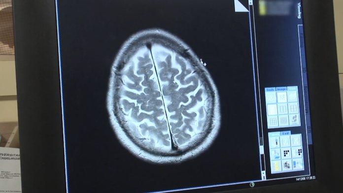 Vedci určili vek, kedy mozog človeka začína starnúť. Rozhodujúca je jedna vec