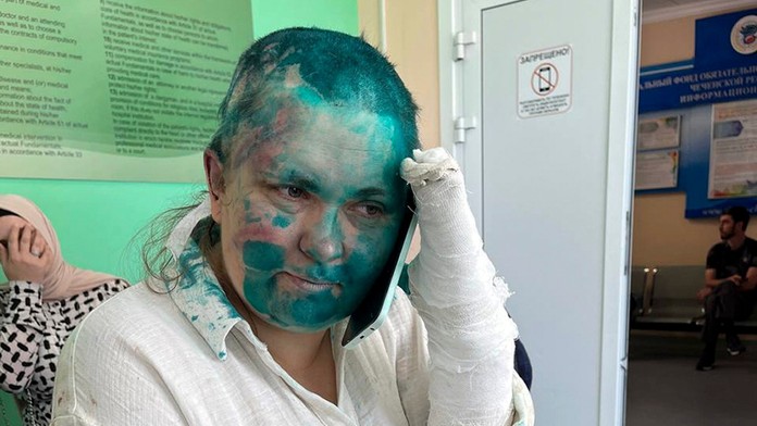 Ruská novinárka Jelena Milašinová