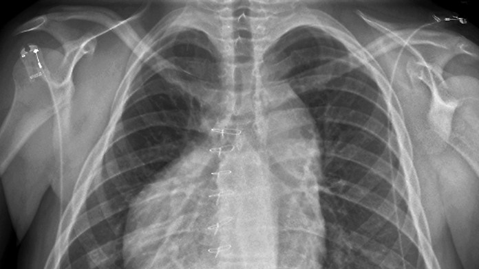 Ilustračná snímka.