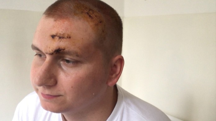 Nesprávna diagnóza ho takmer stála život