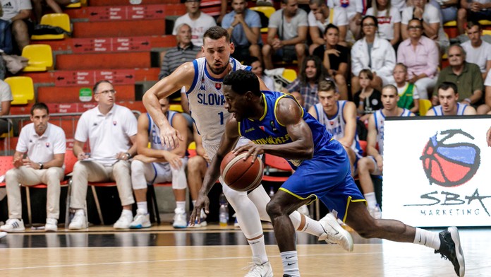 Obe zo siamských dvojčiat z Bangladéša sú už v stabilizovanom stave.