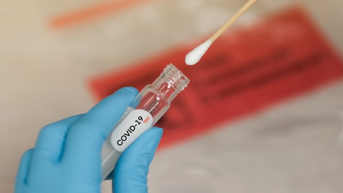 Prekonali ste COVID-19? Hrozí, že vás v budúcnosti postihne niektorá z týchto chorôb