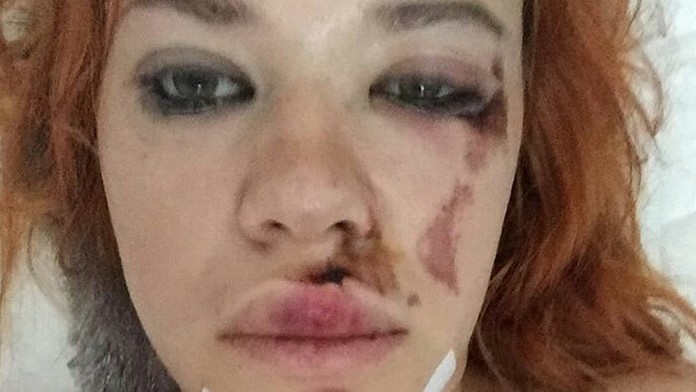 Speváčka zo skupiny Perer Bič Project mala nehodu