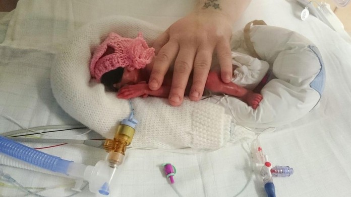 Francesca je podľa lekárov zázračné dieťa. 