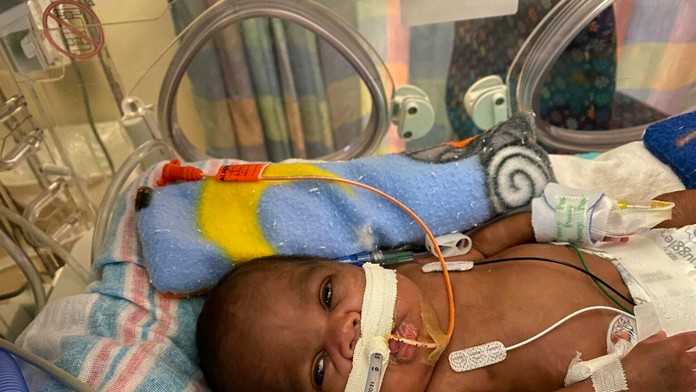 Curtis Means svojím narodením prekonal svetový rekord