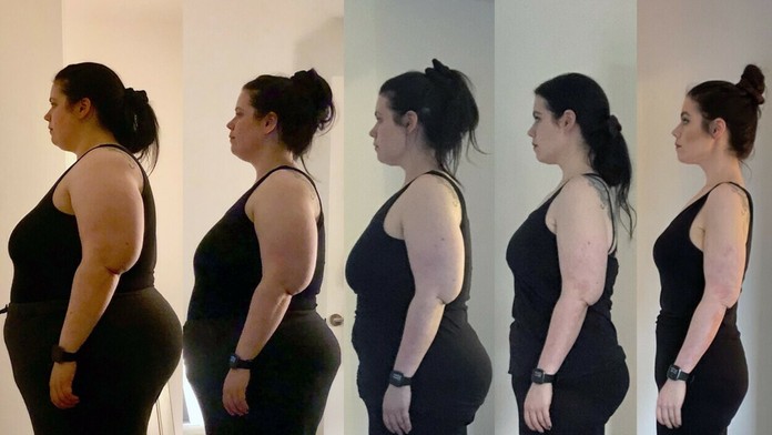 Chudnutie Carly FitzGeraldovej