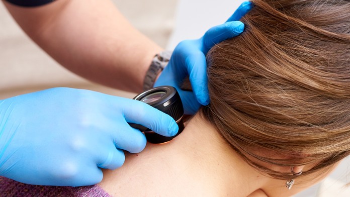 Jeseň je ideálne obdobie na kontrolu materských znamienok. Rakovina kože sa môže rozvinúť rýchlo (rozhovor)