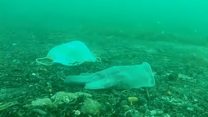 Z peňazí vyzbieraných na liečbu chorého syna si dala spraviť prsia a kúpila si nové auto 