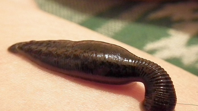 Hrôzostrašný nález. Objavili telo muža vo vani plnej pijavíc