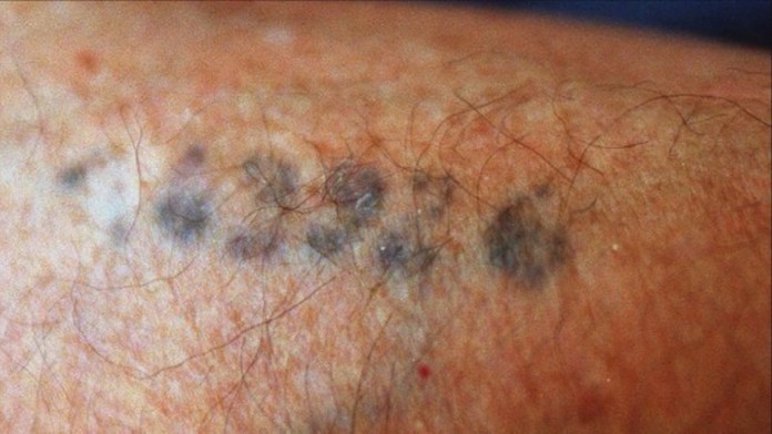 Tetovanie v koncentračnom tábore.