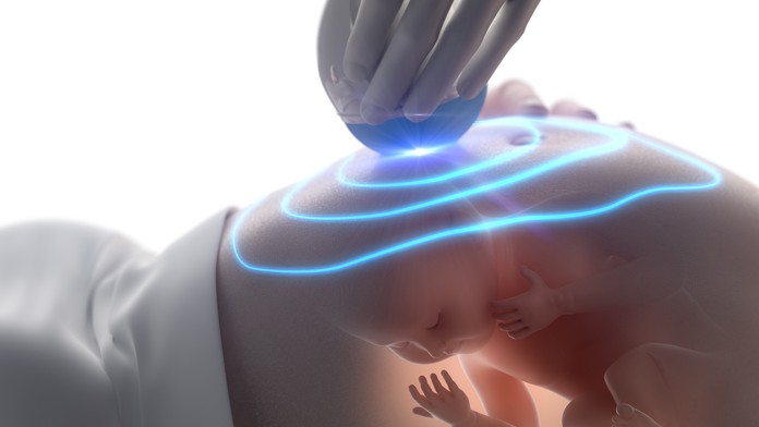 ultrazvuk v tehotenstve