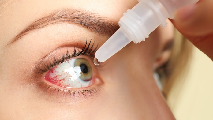 Kvapky na začervenané oči môžu zakryť vážny problém, varujú odborníci