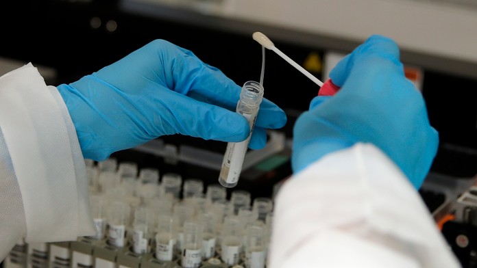 Príprava vzoriek na testovanie koronavírusu.