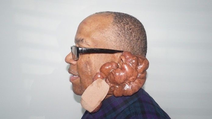 Keith Crowell a jeho trápenie.