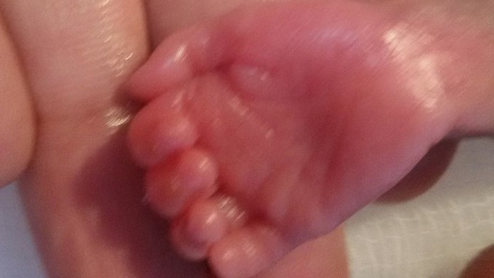 Po narodení vážilo len 270 gramov