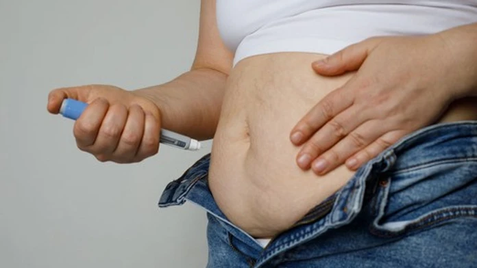 Obezita v USA po rokoch mierne klesla. Výskumníci to sčasti pripisujú populárnemu lieku